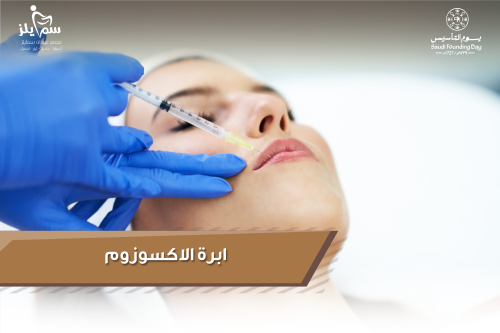 ابرة اكسوزوم