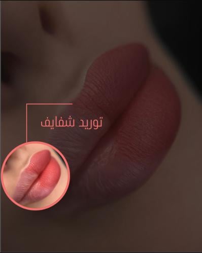 جلسه توريد شفايف