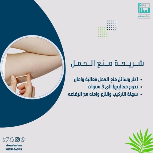 شريحة منع الحمل