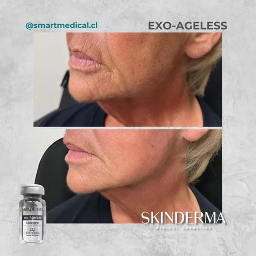 سكين ديرما ageless خلايا جذعية لتجديد البشرة لشباب...