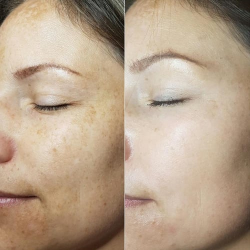 مي لاين 02 كريم ليلي لتفتيح البشرة اثنك سكين ethni...