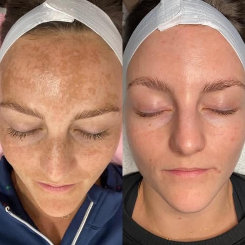 مقشر كوزميلان البارد الاسباني