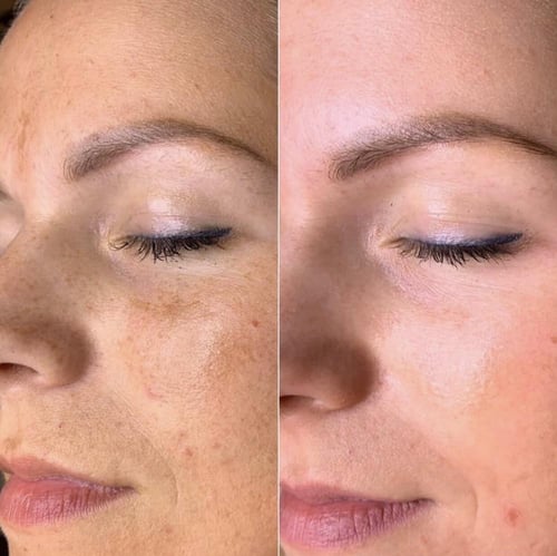 مي لاين 02 كريم ليلي لتفتيح البشرة اثنك سكين ethni...