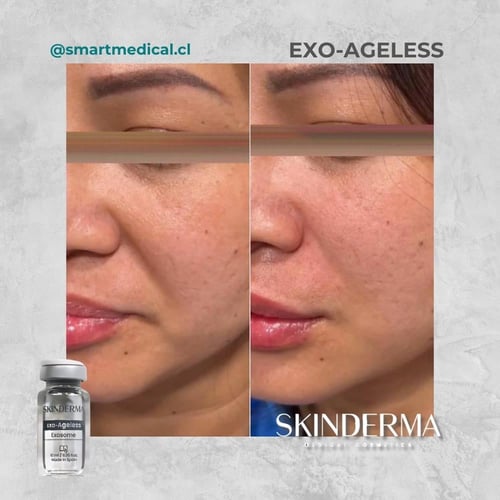 سكين ديرما ageless خلايا جذعية لتجديد البشرة لشباب...