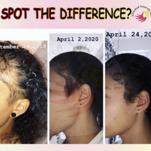 زيت التألق حجم صغير لتحفيز وتطويل الشعر والقضاء ع...