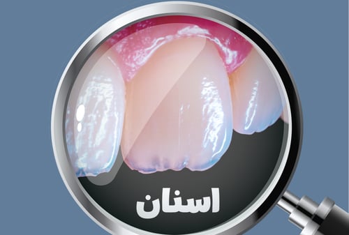 مكبّر الصورة