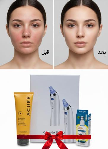 احصلي على بشرة صافية وناصعة — جهاز سوناتا + كريم A...