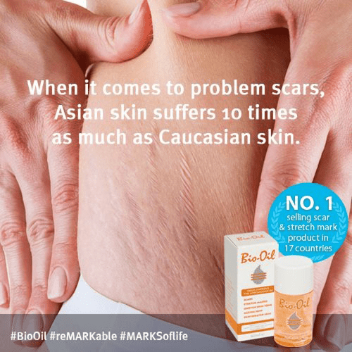 زيت بيو اويل للعناية بالبشرة 25 مل