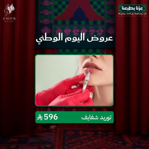 توريد شفايف