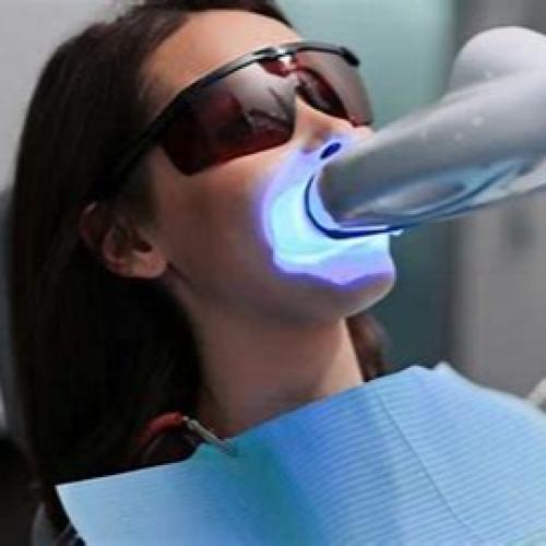 تبييض الأسنان بالليزر