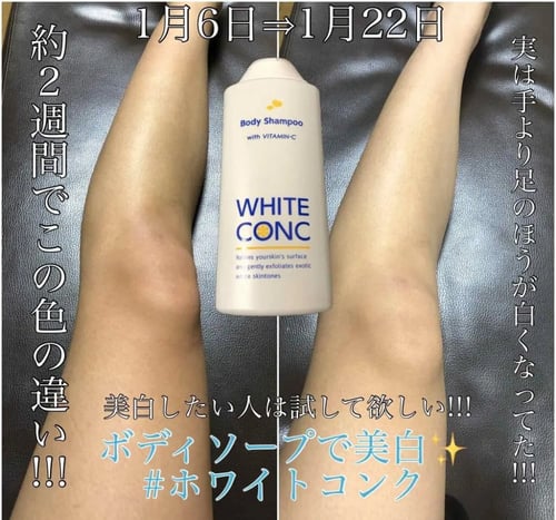 شامبو مبيض للجسم بفيتامين سي WHITE CONC