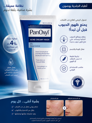 "panoxyl بانوكسيل غسول كريمي لحب الشباب بنزويل بيروكسيد 4٪ - 170ج "