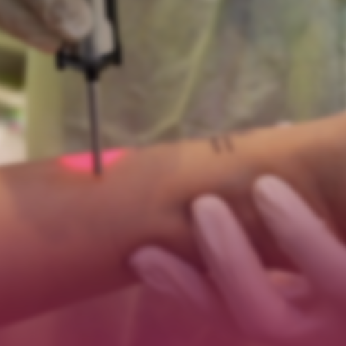 3 full body laser sessions + free eyebrow tinting...