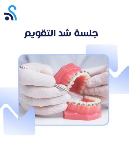 جلسة شد تقويم الاسنان