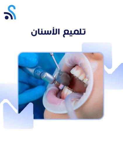 تلميع الأسنان