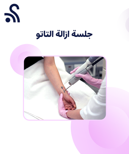جلسة ازالة التاتو (2سم) مع د. أماني سلامة