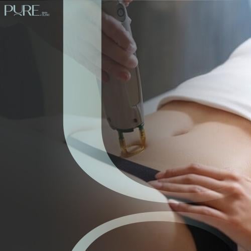 3 جلسات منطقتين ابط + بكينى مع الرتوش