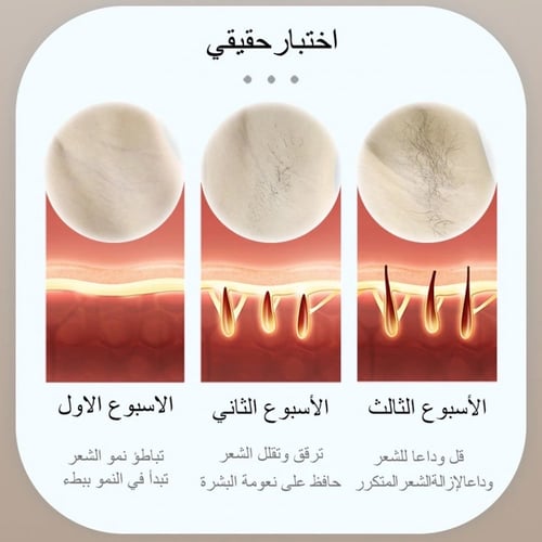 ليزر ملاي T14 بخاصية التبريد و3 عسات (احدث جهاز مل...