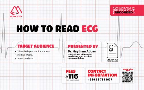 How to read ECG
