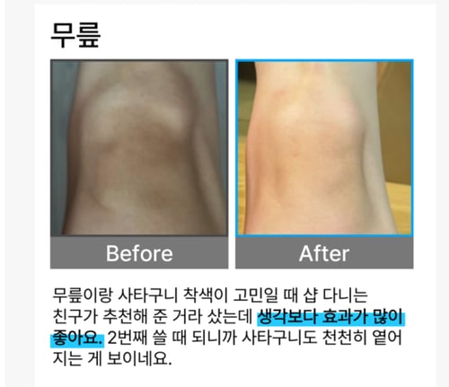 كريم علاجي تقليل الميلانين لتفتيح الإبطين والاكواع...