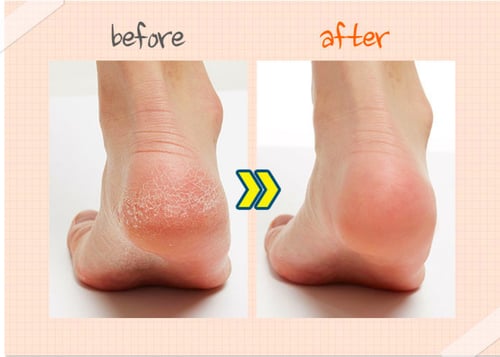 A'PIEU- جورب تقشير القدمين