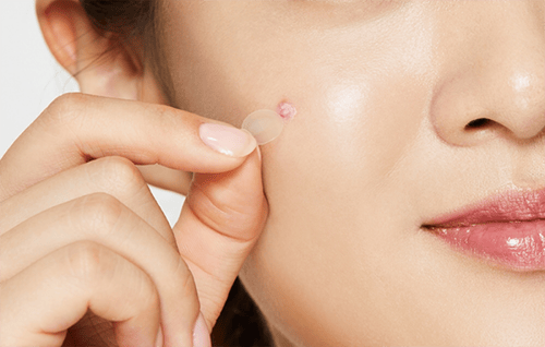 COSRX- رقعات تطهير حب الشباب -