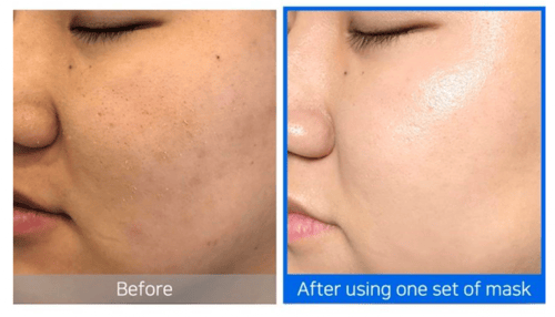 SOME BY MI. قناع الأمبولات اللامعة المضيئة Hyaluro...