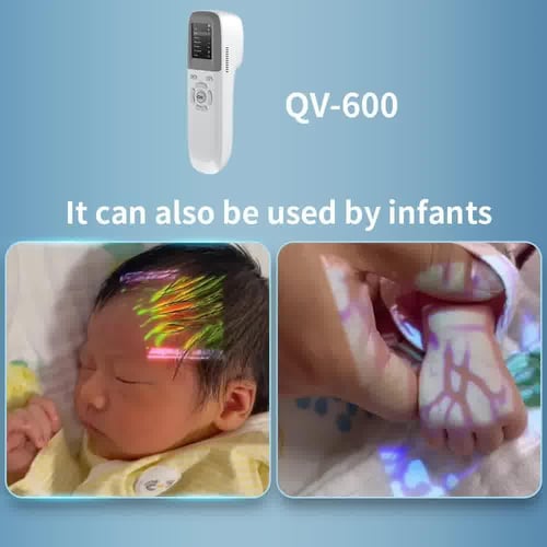 جهاز كاشف الأوردة بالأشعة تحت الحمراء Qualmedi QV-...