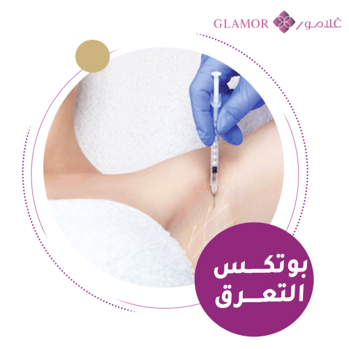 بوتوكس التعرق