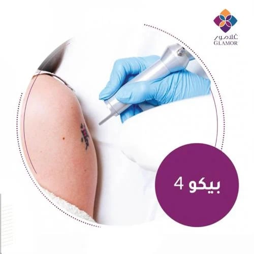 Pico 4 device for tattoo removal