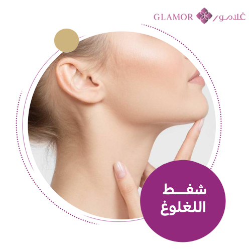 شفظ اللغلوغ