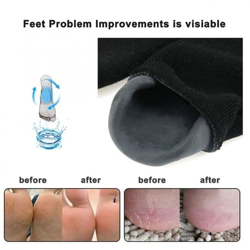 جوارب جل مرطبة للأقدام المتشققه, زوج واحد