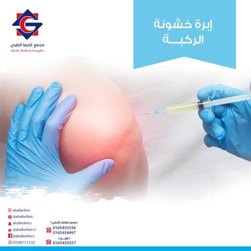 Needle for knee roughness