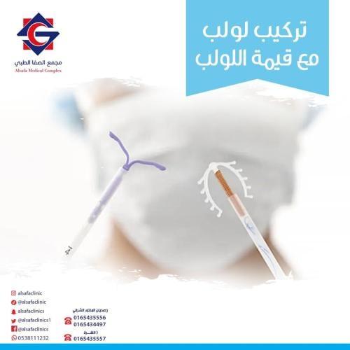 Insertion of a contraceptive device (IUD)