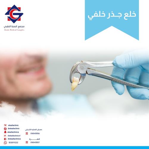 Extraction of a posterior root