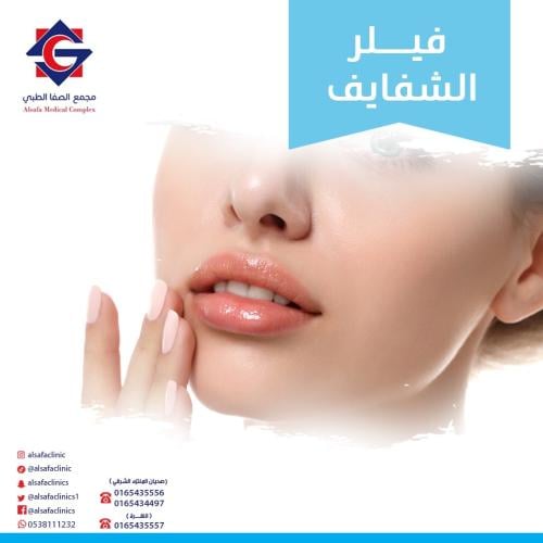 Lip filler 1 ml