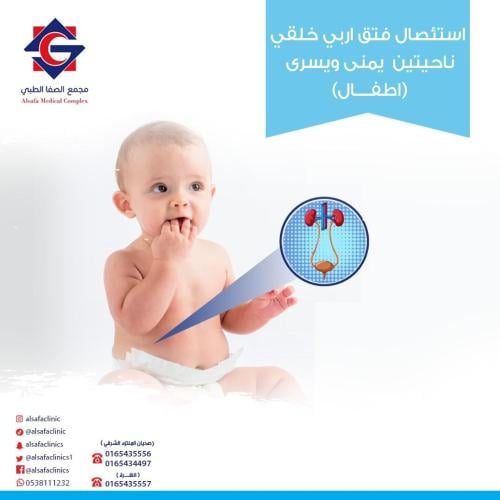 Surgical removal of congenital inguinal hernia on...