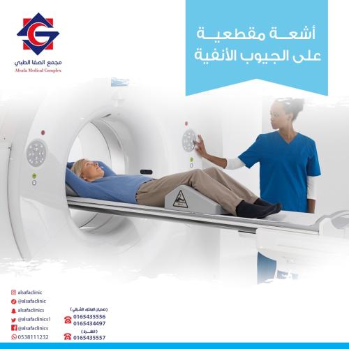 CT scan of the paranasal sinuses (without contrast...