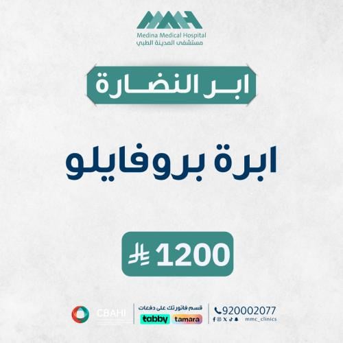 ابرة البرفايلو