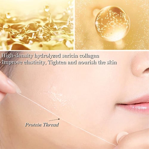 خيوط الكولاجين الذهبي