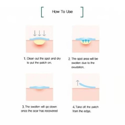 سوم باي مي لاصقات حب الشباب 18 لاصقة