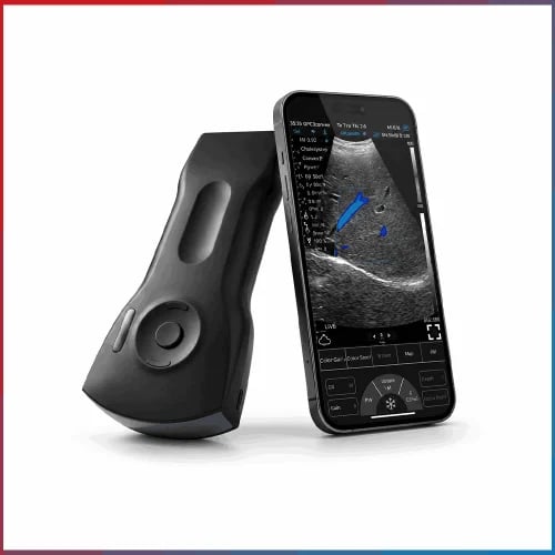 جهاز سونار محمول مزدوج الرأس Dual Head Pocket Ultr...