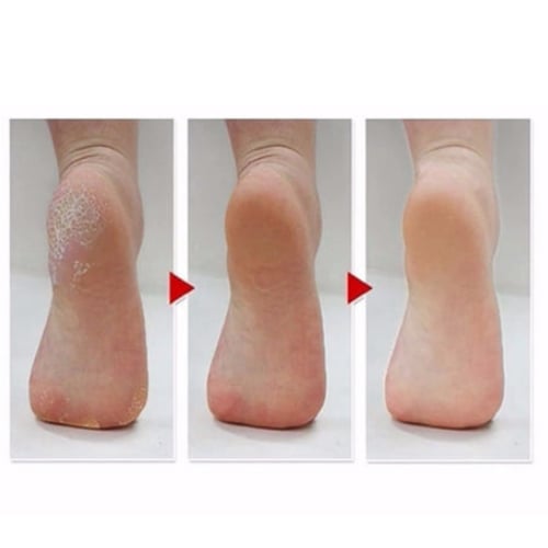 جوارب -ام بيوتي-لتقشير القدمين