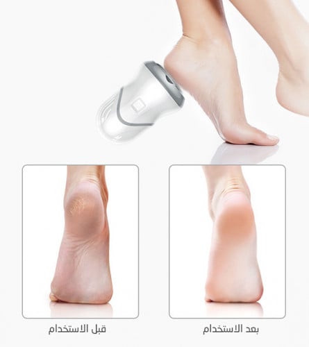 جهاز العناية بالقدم