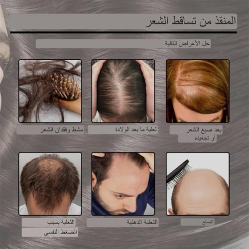 زيت اكليل الجبل لعلاج مشاكل الشعر