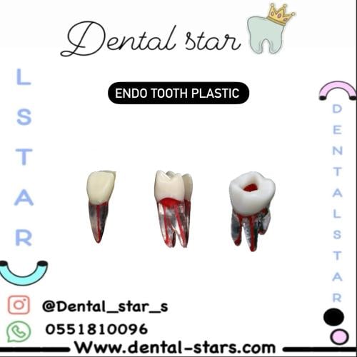 Endo tooth plastic