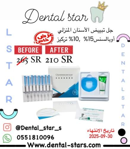 جل تبييض الاسنان المنزلي أوباليسنس 15% ,10% تركيز