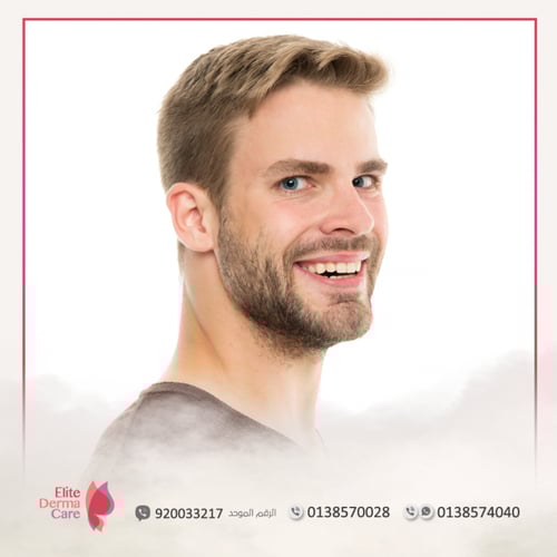 ليزر منطقة السوالف (السيدات أو الرجال)