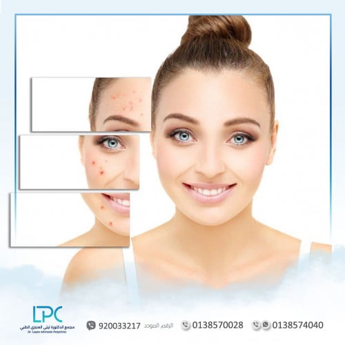 تقطيع ندبات مع تقنية البلازما