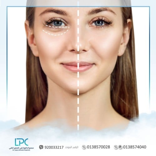 الإكسوزوم د.سعد الصقير